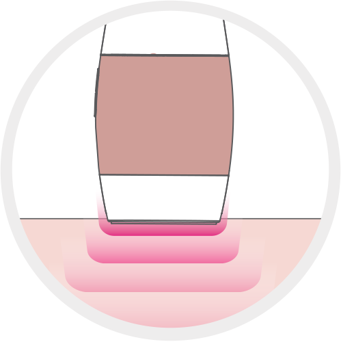 Cilt Temas Sensörü